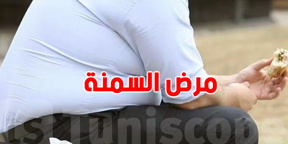 عاجل: وزارة الصحة تحذّر من مخاطر السمنة
